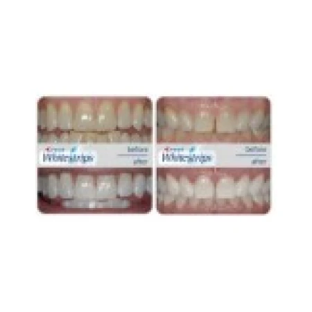 Cutie 12x Plicuri, Benzi Albirea Dintilor, Crest, 3D White, Monthly Whitening Boost, 10% Concentratie, 12 zile