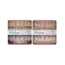 Set 5x Plicuri, Benzi Albirea Dintilor, Crest, 3D White, Monthly Whitening Boost, 10% Concentratie, 5 zile