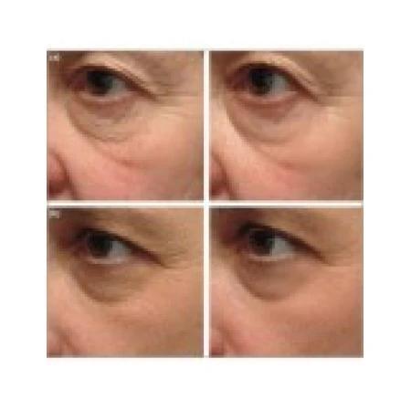 Crema, Dermalogica, Intensive Eye Repair, Anti-Rid, Hidratare Intensiva, pentru Ochi, Tub 15ml