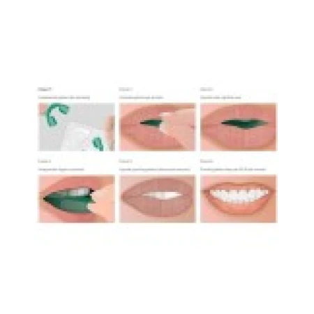 Kit Albirea Dintilor, Opalescence, GO! Concentratie 6%, Aroma Menta, 10 Mulaje
