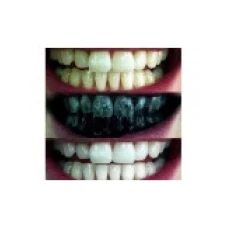 Pulbere Carbune, Glory Smile, Albirea Dintilor Carbune Activ din Bambus, 30gr