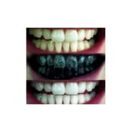 Pulbere Carbune, Glory Smile, Albirea Dintilor Carbune Activ din Bambus, 30gr