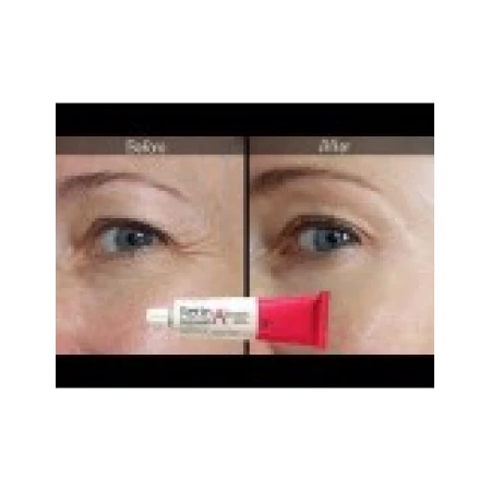 Gel Anti-Rid, Menarini, Anti-Acnee, Tretinoin 0.025%, 20gr