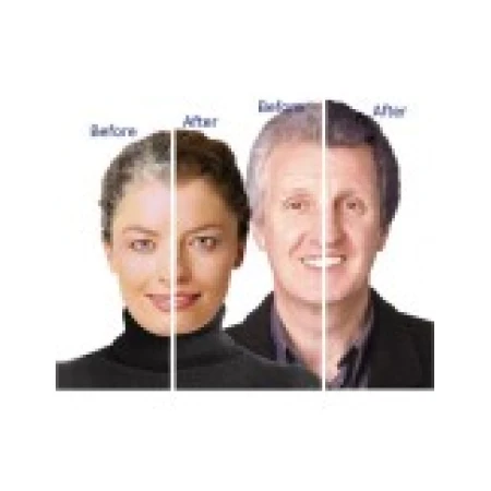 Crema, AII Beauty, Youthair, Repigmentare Par Alb, Tratament 1 Luna, Fara Plumb, 106ml