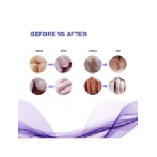 Set 4x Creioane, Ariella, 100% Natural, Tratament Onicomicoza, Pentru 4 luni, 4x3ml
