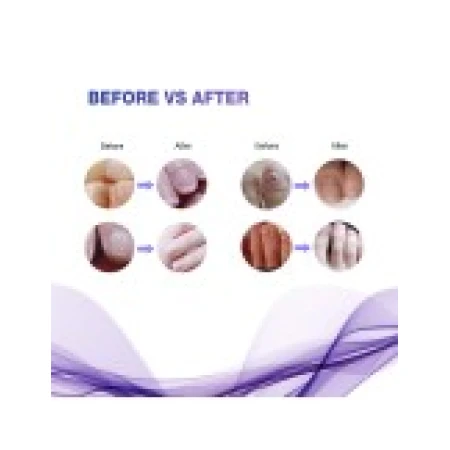Set 4x Creioane, Ariella, 100% Natural, Tratament Onicomicoza, Pentru 4 luni, 4x3ml