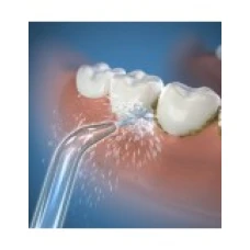Set 2 Rezerve, Waterpik, JT-100E, Capete Jet Normal, pentru Dusuri Bucale Waterpik