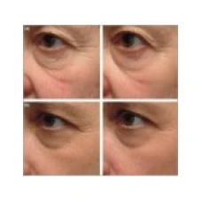 Unguent, Vindecare Rapida, Anti-Rid, Anti-Aging, 20gr