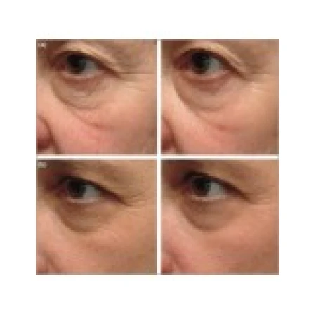 Unguent, Vindecare Rapida, Anti-Rid, Anti-Aging, 20gr