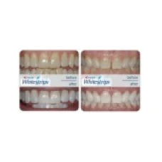 Cutie 12x Plicuri, Benzi Albirea Dintilor, Crest, 3D White, Classic Vivid, 9% Concentratie, 12 zile