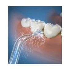 Set 2x Rezerve, Waterpulse, ST-300, Varfuri Clasice, pentru Dusuri Bucale Waterpulse