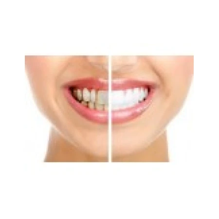 Set 8x Benzi Albirea Dintilor, Crest, 3D White, Brilliance White, 10% Concentratie, 16 zile